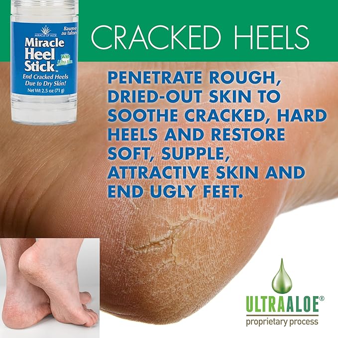 Heel Balm for Dry Cracked Feet – Miracle Heel Stick with Foot Repair Cream – Repairs Dry, Cracked Heels & Feet – Ultra Aloe Formula Moisturizes, Softens & Restores – Ideal for All Ages