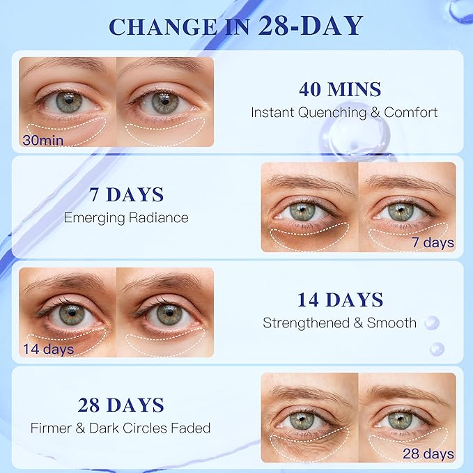 ICIKOL Under Eye Mask Reduce Dark Circles, Puffy Eyes, Undereye Bags, Wrinkles, Collagen Under Eye Patches, White Elephant Gifts for Adults, Vegan - Self Care(12 Pairs, Blueberry)