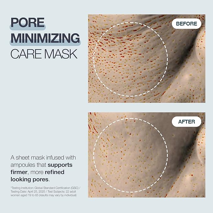 POESIA EGF Cooling + Recovery Sheet Mask Set – -8°C Instant Chill | Korean Pore-Refining Face Mask with Allantoin, Witch Hazel & Ceramides | 5 Sheets | Soothes, Brightens, Tightens