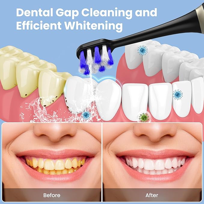 UNINGOPI Portable Electric Toothbrush with Water flosser, 2 in 1 Teeth Cleaning Kit, Electricc, Toothbrush and Water flosser Combo, Travel Toothbrush with Water Bottle(Black)