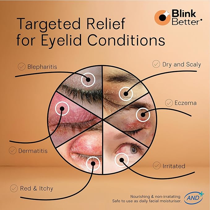 BlinkBetter® Restore Eyelid Cream – 3% Oat Extract & Ceramide Complex – Soothing Hydration & Barrier Support for Dry, Itchy, Red, Sensitive, or Flaky Skin Around the Eyes – All-Day Use – 1oz