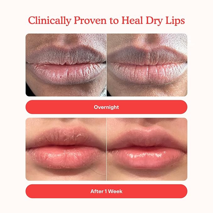 Tower 28 LipSoftie Hydrating Tinted Lip Treatment Balm, Moisturizing Lip Mask for Chapped Lips - Red Bean Mochi, Sheer Rosy Nude