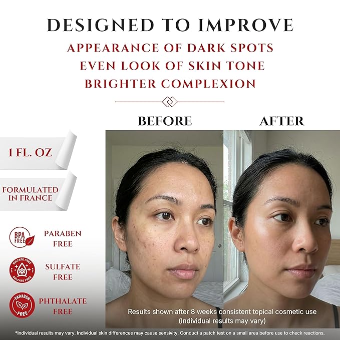 Tranexamic Acid TXA 4% + Niacinamide 10% Serum – Discoloration Correcting Serum with Alpha Arbutin, Pro-Vitamin B5, Phloretin Dark Spot, Hyperpigmentation, Uneven Skin Tone Corrector 1 fl oz