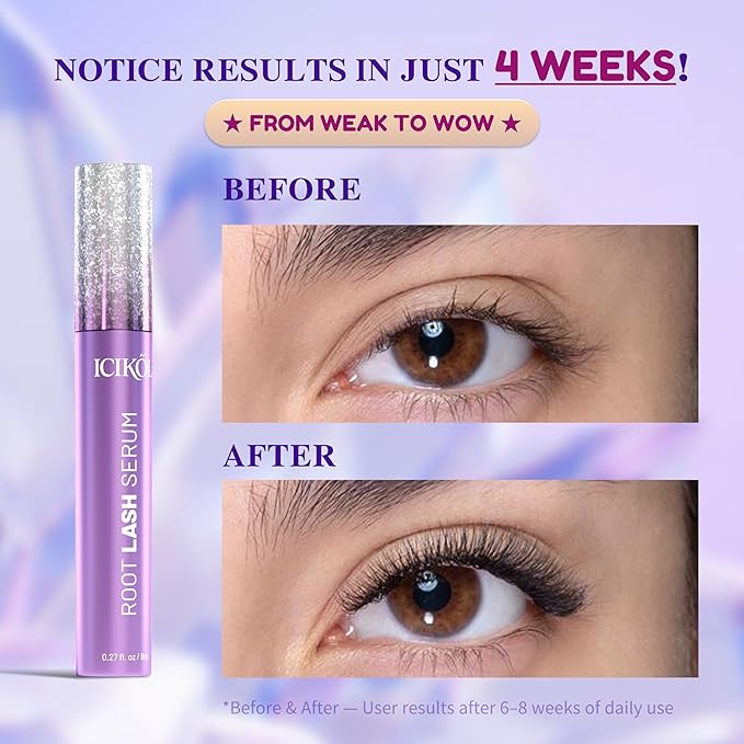 ICIKOL Lash Serum for Eyelash Growth, Advanced Peptide & Biotin Formula for Thicker, Fuller, Longer Lashes in 4-6 Weeks, Prostaglandin-Free Lash Enhancer for Women 35+ (Eyelash Serum - 16mL)