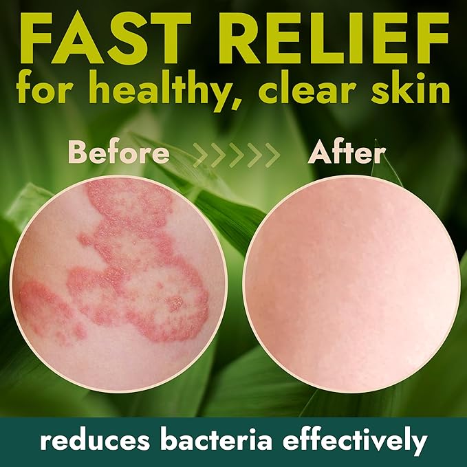 Antibacterial Body Lotion | Kills 99.9% of Germs & Bacteria | Body Lotion for Women & Men Helps Sanitize Skin | Infused with Botanical Extracts | Fresh, Soft & Moisturized Skin | 4 fl oz
