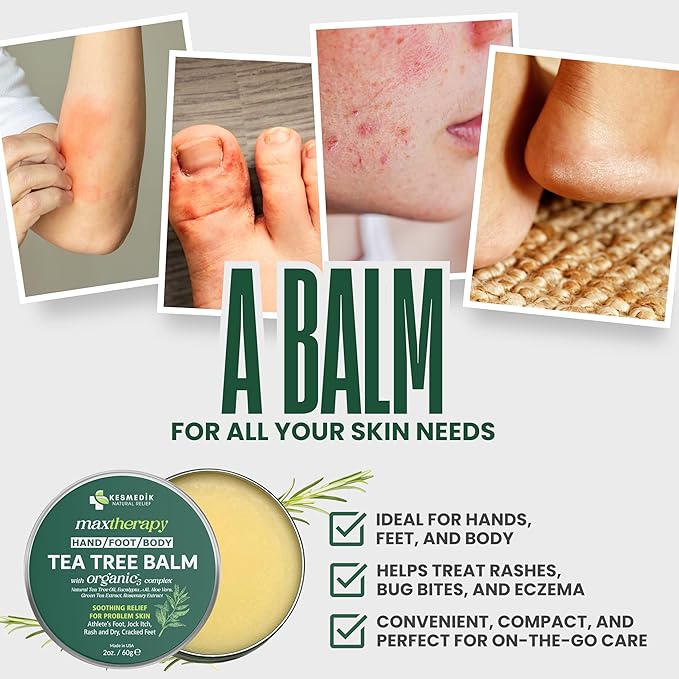 Tea Tree Oil for Skin, MaxTherapy Tea Tree Balm, Dry Itchy Skin & Rash Relief, Athlete’s Foot & Dry Feet Itching, Jock Itch, Chafing, Bug Bites, Natural, Effective & Safe for All Ages