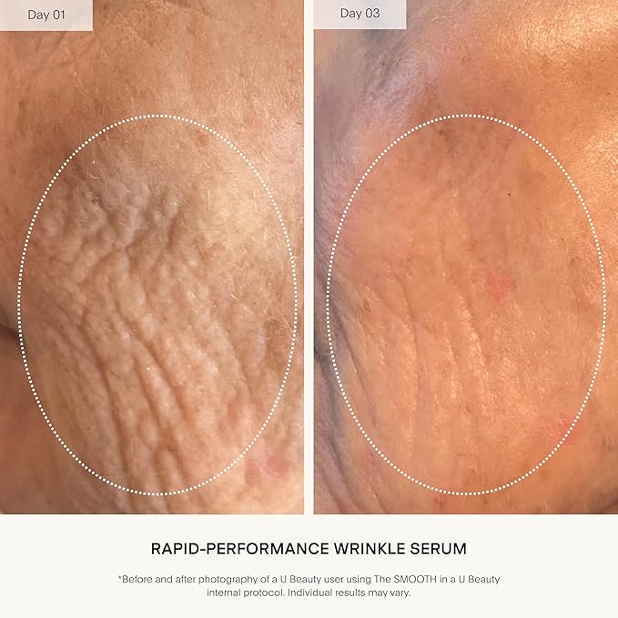 U Beauty The SMOOTH Dynamic Wrinkle Defense Serum - Multi-Peptide Complex, Copper Peptides, Retinol, Centella Exosomes, Vegan Silk Protein for Visible Wrinkle Reduction, Firming & Hydration, 30ml