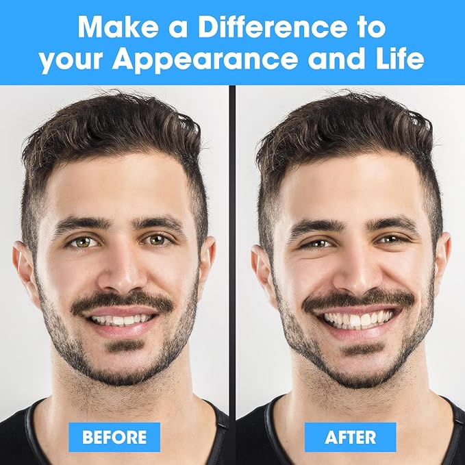 CXYARY 2024 Upgraded Model 6PCS Jaw Exerciser 3 Resistance