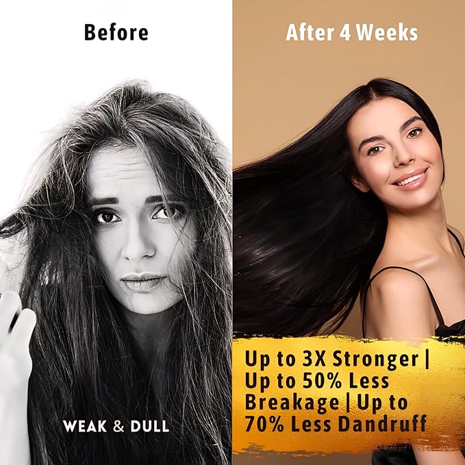 Hair Growth Serum Women & Men — USDA Organic Tricho10™ Natural Scalp Serum with 10 Botanical Oils for Reduced Shedding, Improved Hair Density & Visible Hair Growth in 90 Days — All Hair Types (30 ml)