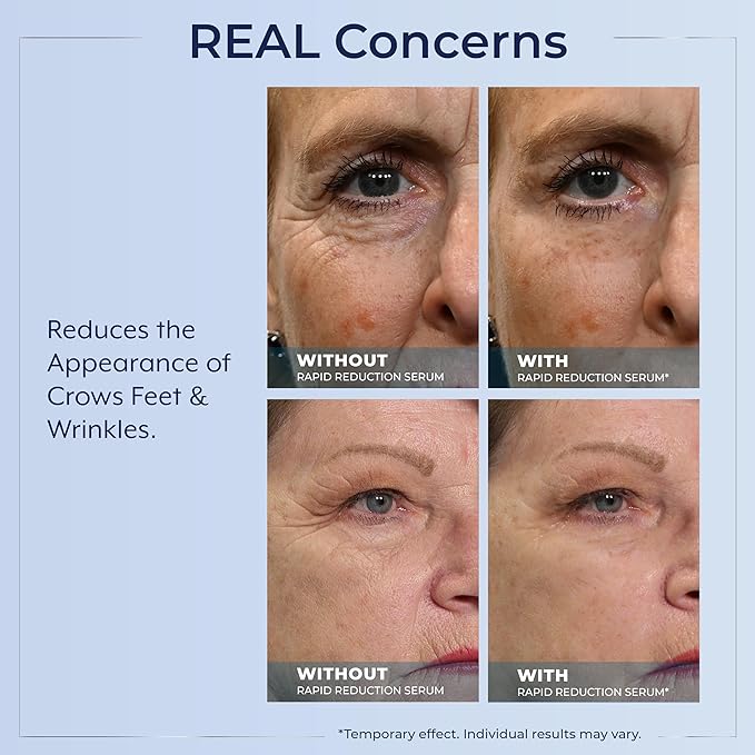 Plexaderm Rapid Reduction Eye Serum - Visibly Reduces Under-Eye Bags, Wrinkles, Dark Circles, Fine Lines & Crow's Feet Instantly, Anti Aging Wrinkle Remover for Face, Pump