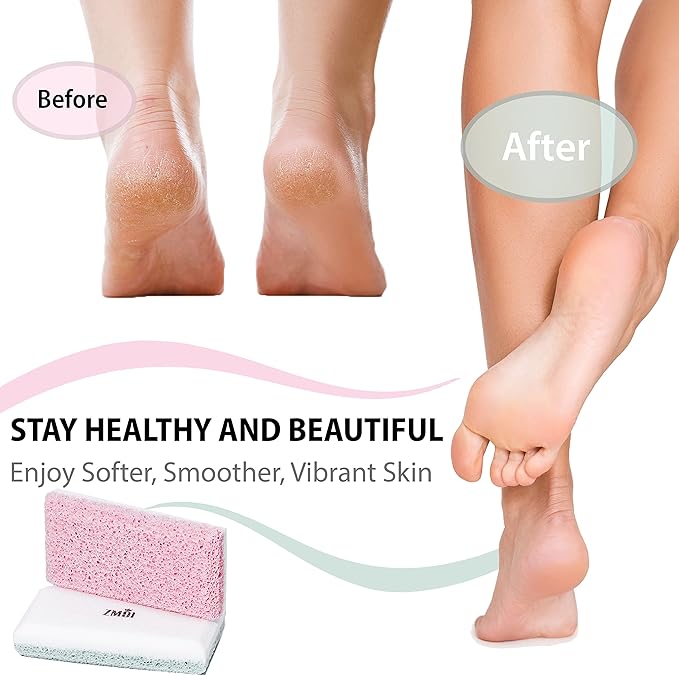 Glass Pumice Stone Callus Remover for Feet, Elbows, Hands, and Knees, Spain Made - 2 in 1 Pedicure Exfoliator and Scrubber for Rough, Hard Skin (Teal Color)