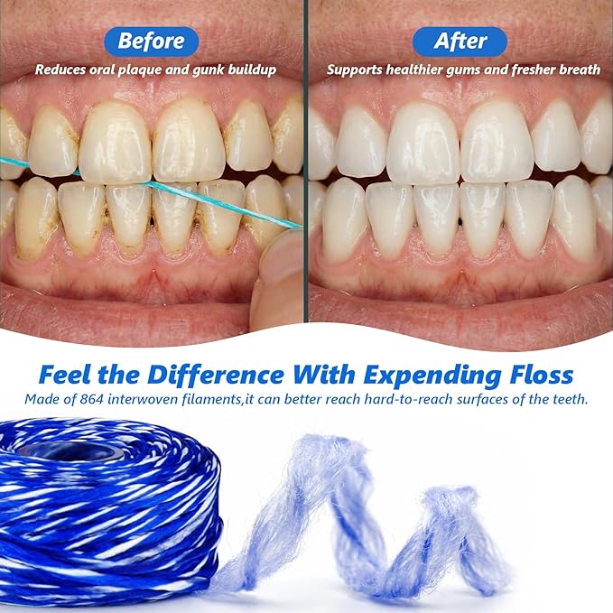Woven Dental Floss, Expandable Waxed Dental Floss for Gentle,Oral Care Whitening Dental Floss,Plaque Remover for Teeth, Kid-Friendly String Floss,Mint,20 Spools (32.8 yd Each)