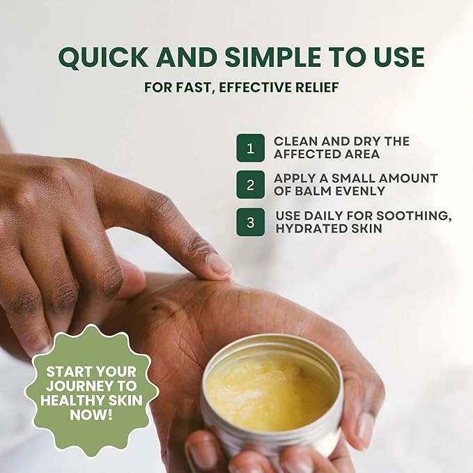 Tea Tree Oil for Skin, MaxTherapy Tea Tree Balm, Dry Itchy Skin & Rash Relief, Athlete’s Foot & Dry Feet Itching, Jock Itch, Chafing, Bug Bites, Natural, Effective & Safe for All Ages, 2-pack