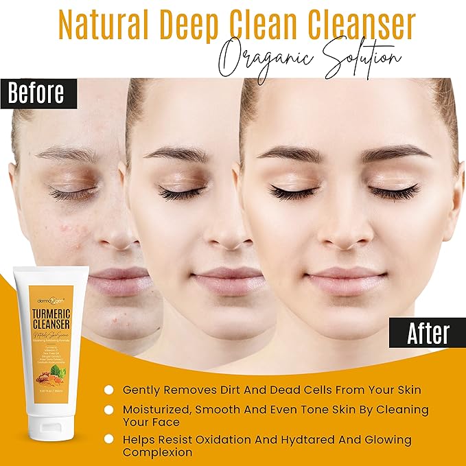 DERMAXGEN Turmeric Facial Cleanser – Natural Anti-Aging Exfoliating Turmeric Face Wash for Glowing Skin – Helps Clear Acne Scars, Dark Spots, Sun Damage & Discoloration – 5 oz