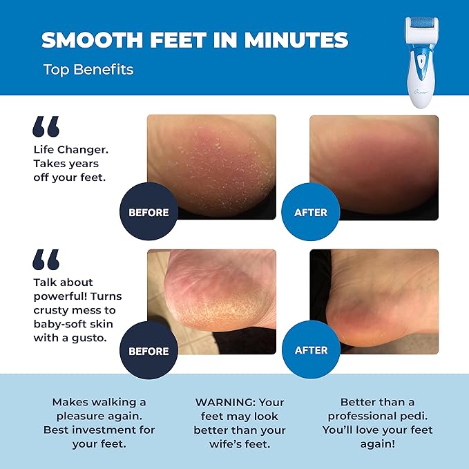 Electric Callus Remover: Own Harmony Professional Pedicure Tools Foot Care for Women, Rechargeable Foot Scrubber, CR900 Electronic Feet File Pedi Sander Best for Hard Cracked Dry Dead Skin, 3 Rollers