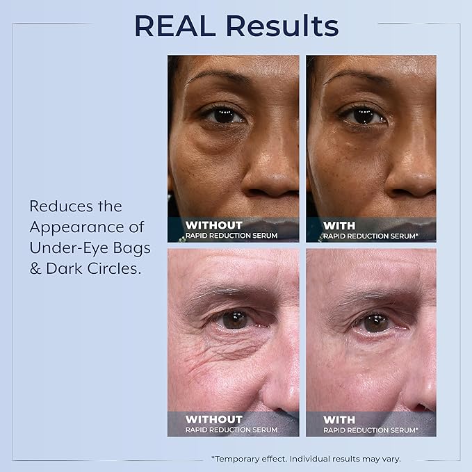 Plexaderm Rapid Reduction Eye Serum - Visibly Reduces Under-Eye Bags, Wrinkles, Dark Circles, Fine Lines & Crow's Feet Instantly, Anti Aging Wrinkle Remover for Face, Pump