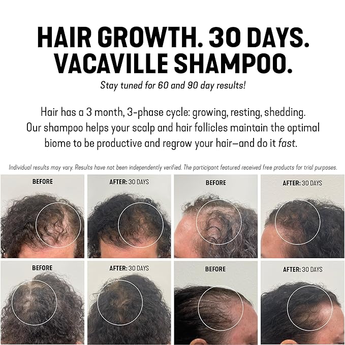 Vacaville Beauty Shampoo Gift Set: Peppermint Powder Shampoo & Conditioner for All Hair Types - Vegan, Eco-Friendly, Cruelty-Free - Botanical Ingredients Clinically Proven to Promote Hair Growth