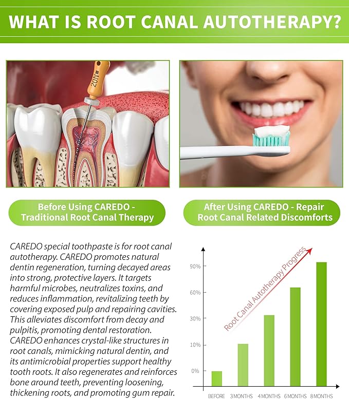 Toothpaste Gum Repair for Avoid Root Canal Therapy, Gingivitis Treatment for Pulpitis Discomforts and Tooth Repair, Remineralizing Hydroxyapatite Toothpaste for Root Canal Discomforts, Mint 3.52 OZ
