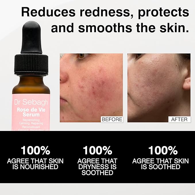 Dr Sebagh Rose de Vie Serum - 0.17 fl oz - Award-Winning Nourishing Anti-Aging Formula - Use with Dry, Mature, or Sensitive Skin - Designed to Soothe Redness & Irritation - Regenerating & Invigorating