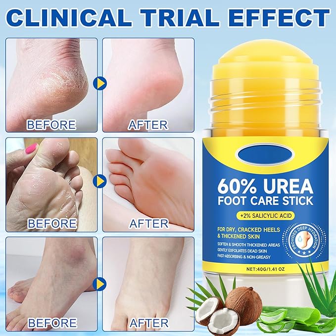 60% Urea Foot Cream Stick with 2% Salicylic Acid, Maximum Strength Urea Foot Cream Callus Remover for Dry Cracked Heels, Hands, Knees,Exfoliating Moisturizer, Dead Skin Remover Foot Balm 1.4oz