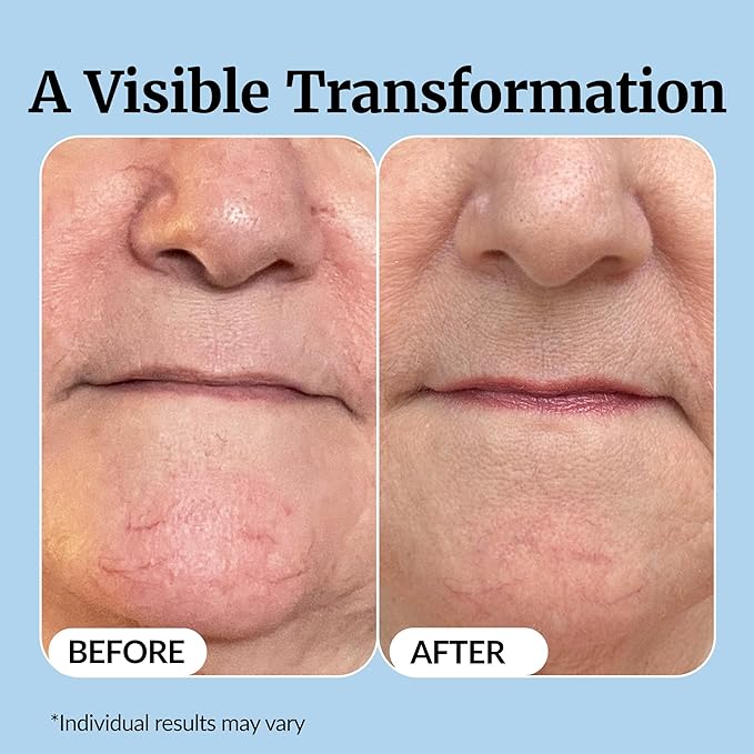 Vibriance Super C Serum for Mature Skin - All-in-One Vitamin Formula Hydrates, Firms, Lifts, Smooths, Targets Age Spots, Wrinkles, 1 fl oz - Pack of 2