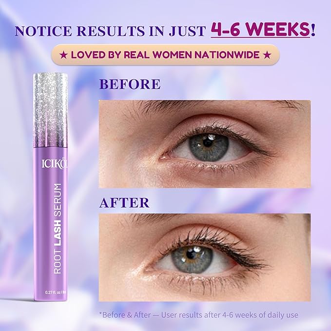 ICIKOL Eyelash Growth Serum, Advanced Lash Enhancing Treatment - Peptide & Vitamin Formula for Longger, Thicker and Fuller Looking Lashes, Vegan & Cruelty - Free for Sensitive Eyes, 8mL/ 0.27 fl oz