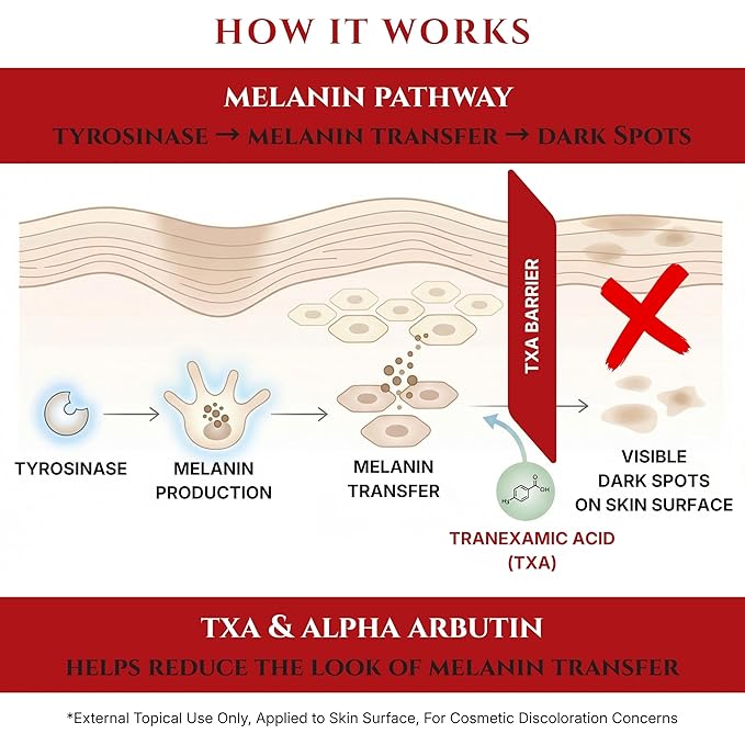 Tranexamic Acid TXA 4% + Niacinamide 10% Serum – Discoloration Correcting Serum with Alpha Arbutin, Pro-Vitamin B5, Phloretin Dark Spot, Hyperpigmentation, Uneven Skin Tone Corrector 1 fl oz
