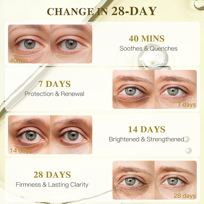 ICIKOL Collagen Under Eye Patches for Puffy Eyes and Dark Circles, Under Eye Mask for Dark Spots with Turmeric, Hydrating Undereye Mask Patches, Christmas Small Gifts for Women (12 Pairs, Turmeric)