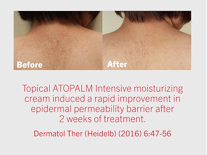 ATOPALM | Intensive Moisturizing Cream | Face & Body Moisturizer | For Dry & Sensitive Skin | Paraben-Free Lotion | Replenishes Hydration | Skin Barrier Repair | Korean Skin Care | 3.4 fl oz (100ml)