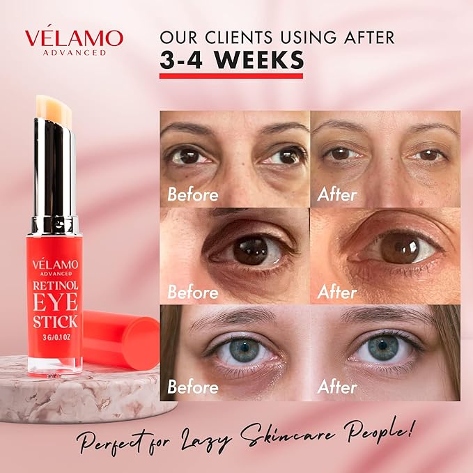 VELAMO ADVANCED Retinol Eye Stick: Renewing & Firming Under Eye Balm for Dark Circles, Puffiness, Fine Lines & Wrinkles - Travel Essentials, Portable & Perfect for On-the-go Use, 0.1 OZ/3g