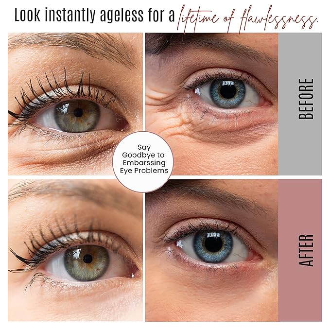 Dermaxgen Instant Eyelift Cream Time Reverse Treatment For Dark Circles, Puffy Eyes, & Wrinkles Anti Aging Serum Reduces Under Eye Bags, Wrinkles, Dark Circles, Fine Lines & Crow's Feet Instantly - 12
