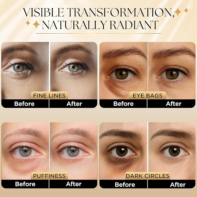 Gianna Demure Undereye Mask Patches for Dark Circles, Puffiness & Wrinkles, Gold Eye Mask with Collagen, Caffeine & Hyaluronic Acid, Vegan & Cruelty-Free Eye Patches for Women and Men (24 Pairs)