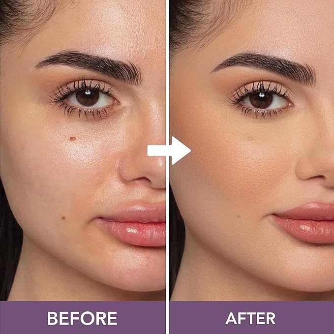Dermaflage Waterproof Concealer Cream - Full Coverage, Matte Finish, Covers Dark Circles, Tattoos, Acne (Light)