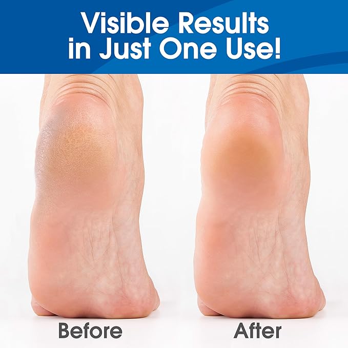 Callus Remover for Feet, Extra Strength Foot Callus Remover Gel, 16oz Salon Grade Home Pedicure Supplies for Dry Skin, Cracked Heel, Professional Strength Foot Care, Unscented