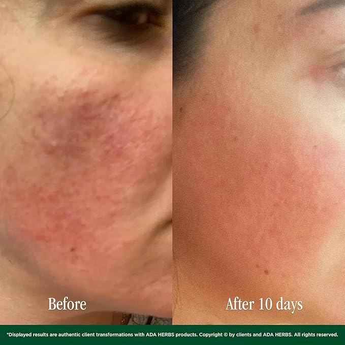 Green Goddess Niacinamide 5% Face Serum - Brightening Serum with Vitamin C Peptides & Bisabolol - Dark Spot Corrector Anti-Aging Hydrating for All Skin Types - 99% Natural (1.76 oz)