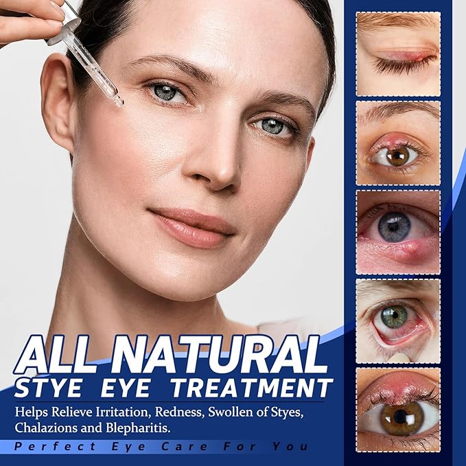 Stye Eye Treatment, Chalazion Treatment Serum, Stye & Blepharitis Remover with Hippophae Rhamnoides Fruit, Helichrysum Angustifolium Flower & Persea Gratissima Oil ((1 Fl. OZ (Pack of 1)))