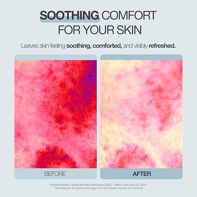POESIA EGF Cooling + Recovery Sheet Mask Set – -8°C Instant Chill | Korean Pore-Refining Face Mask with Allantoin, Witch Hazel & Ceramides | 5 Sheets | Soothes, Brightens, Tightens
