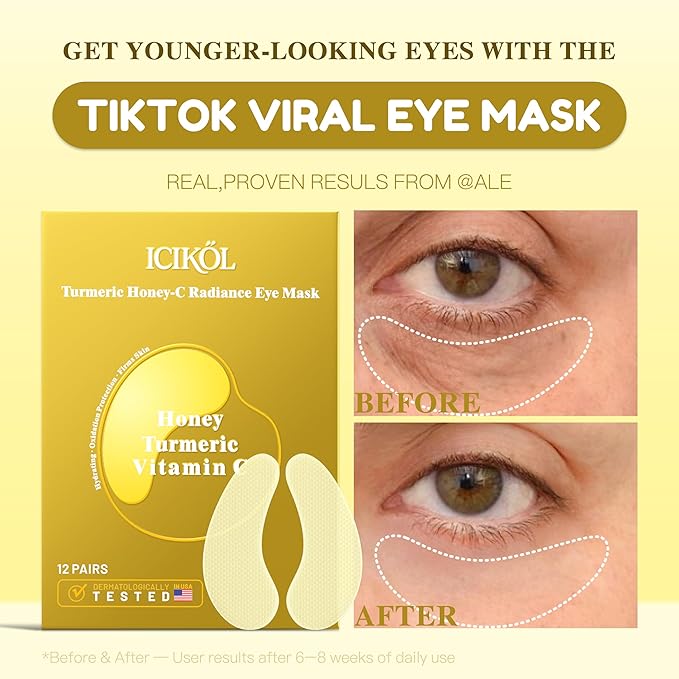 ICIKOL Collagen Under Eye Patches for Puffy Eyes and Dark Circles, Under Eye Mask for Dark Spots with Turmeric, Hydrating Undereye Mask Patches, Christmas Small Gifts for Women (12 Pairs, Turmeric)