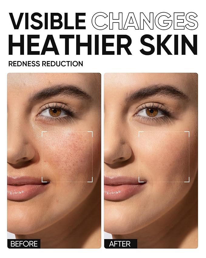 SKINTIFIC Face Moisturizer with 5X Ceramides, Hydrating Moisture Barrier Repair Cream for Oil/Dry Skin Types, Hyaluronic Acid & Centella, Daily Facial Moisturizer, Non-Comedogenic 30 g / 1 fl. oz.