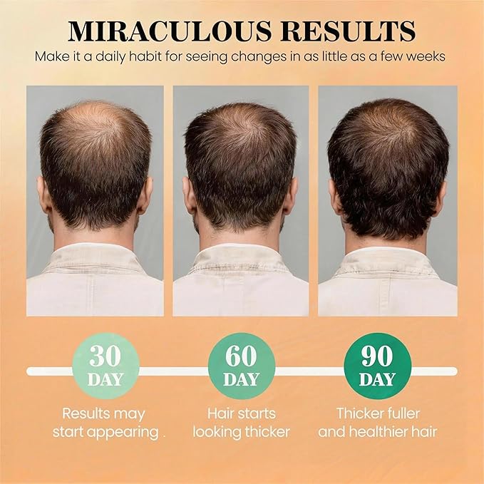 Batana Oil for Hair Growth Dr Sebi, 100% Raw Organic Batana Hair Mask from Honduras, Wild Growth Hair Oil, Scalp Oil Promotes Hair Thickness, Prevents Loss for Men & Women, 4.06 fl oz