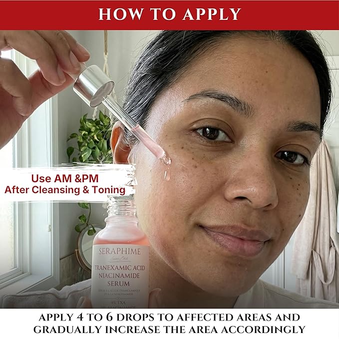 Tranexamic Acid TXA 4% + Niacinamide 10% Serum – Discoloration Correcting Serum with Alpha Arbutin, Pro-Vitamin B5, Phloretin Dark Spot, Hyperpigmentation, Uneven Skin Tone Corrector 1 fl oz