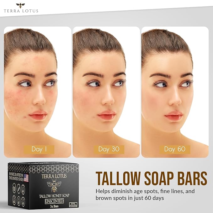 Terra Lotus - Organic Tallow Soap with Organic Castor Oil & Raw Honey - Relief for Dark Spots, Acne Marks, Hydrating & Nourishing - 3 Pack (Lavender)