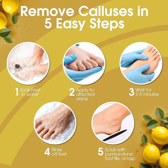 Callus Remover for Feet, Extra Strength Foot Callus Remover Gel, 8oz Salon Grade Home Pedicure Supplies for Dry Skin, Cracked Heel, Professional Strength Foot Care, Lemon