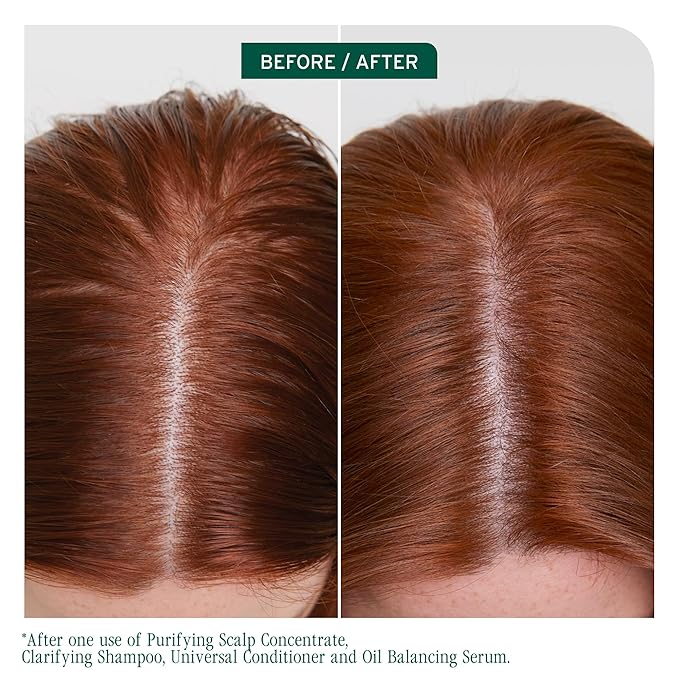 Biolage Scalp Sync Clarifying Shampoo - Residue & Buildup Remover, For Oily Scalp, Fermented Tea & Glycolic Acid, Vegan & Paraben-Free, 13.5 Fl Oz, Packaging may vary
