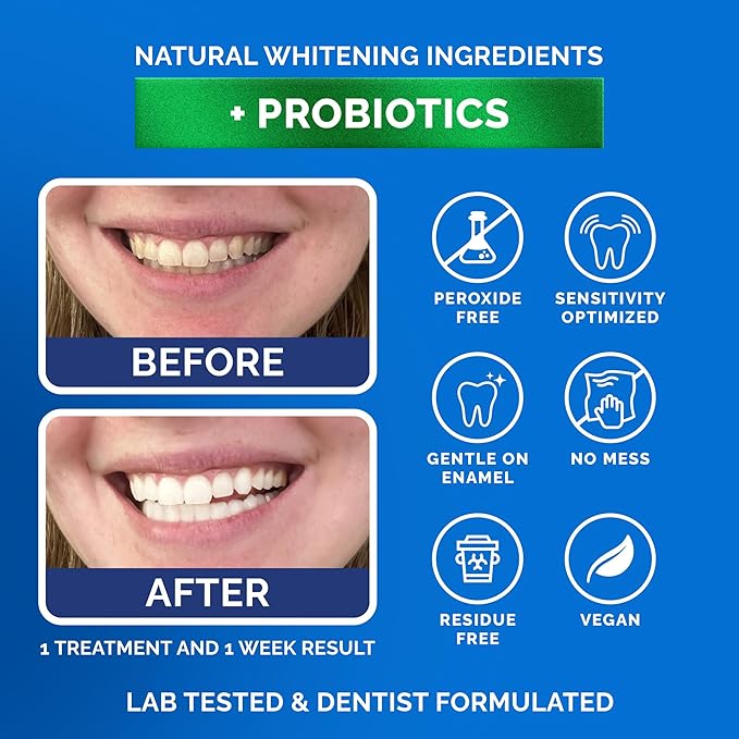Teeth Whitening Strips by Pop On, 14 Strips, 7-Day Treatment, Non-Slip, Sensitive Teeth Whitening Strips, Made with Natural Ingredients, Coconut Oil, with Essential Probiotics, Hydrogen Peroxide Free