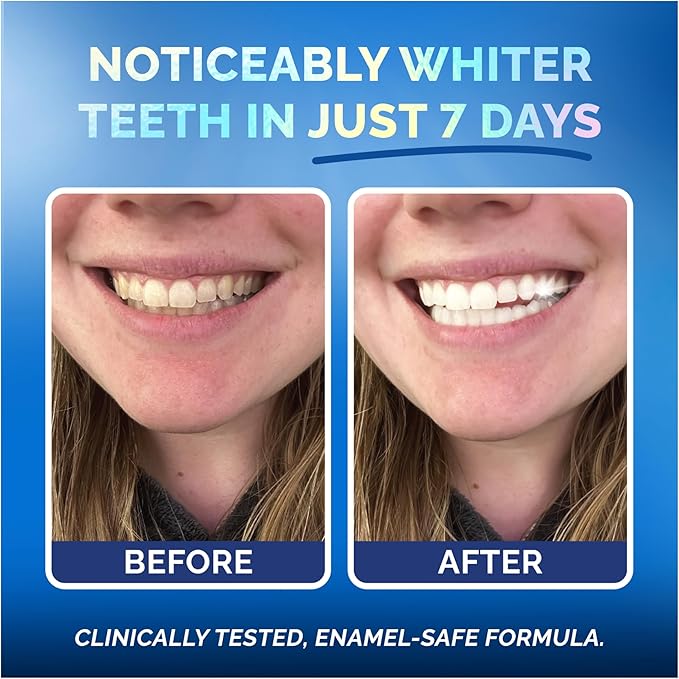 Whitening Strips for Sensitive Teeth – Enamel Safe, Peroxide-Free Coconut Oil Teeth Whitening Strips with Natural Enzymes – Gentle White Stips for Sensitive Gums (28 Count (Pack of 1), Mint)