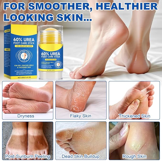 60% Urea Foot Cream Stick with 2% Salicylic Acid,Foot Care Cream Moisturizer for Dry Cracked Feet, Knees, Elbows, Hands,Moisturizes and Hydrates the Dry Skin,Callus Remover&Soften Dead Skin