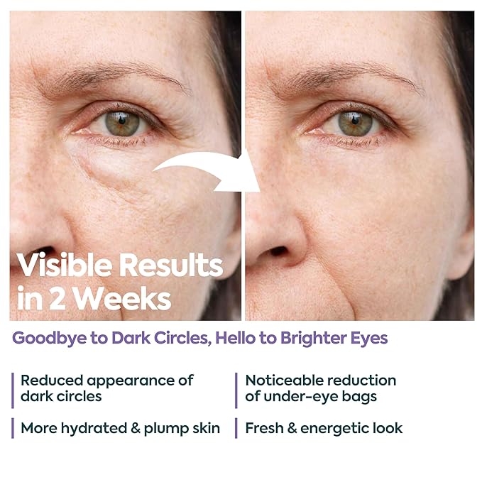 Clasy Care Under Eye Cream for Dark Circles and Puffiness – 5% Caffeine + 2% Hyaluronic Acid – Eye Brightening Cream for Wrinkles, Bags, Fine Lines – Korean Eye Cream for Women