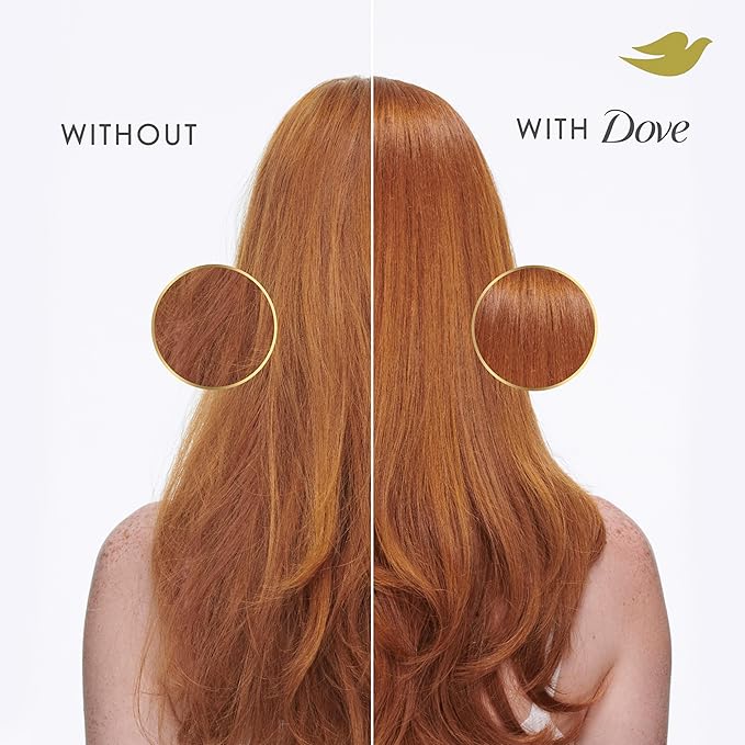 Dove Shampoo 4 Pack Intensive Repair for Damaged Hair with Bio-Protein Care Technology and Amino Serum 28 Fl Oz