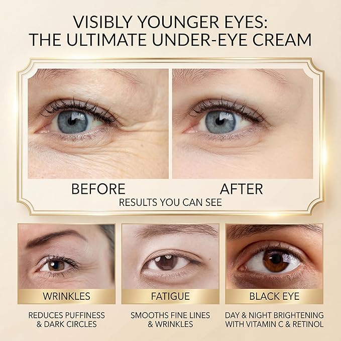 Retinol Under Eye Cream for Dark Circles, [Vitamin C] Remove Puffiness & Wrinkles, Day & Night Brightening Anti-Aging Eye Cream for Fine Lines, 0.67 Fl Oz